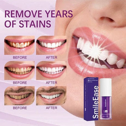 Teeth Brightening Hismiles V34 Colour Corrector Serum – 30ml | Hismile For Teeth Brightening